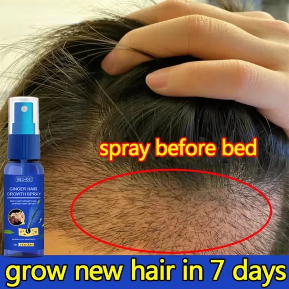 Hair Care Frizzy Hair - بخاخ الزنجبيل السريع لنمو الشعر، مصل