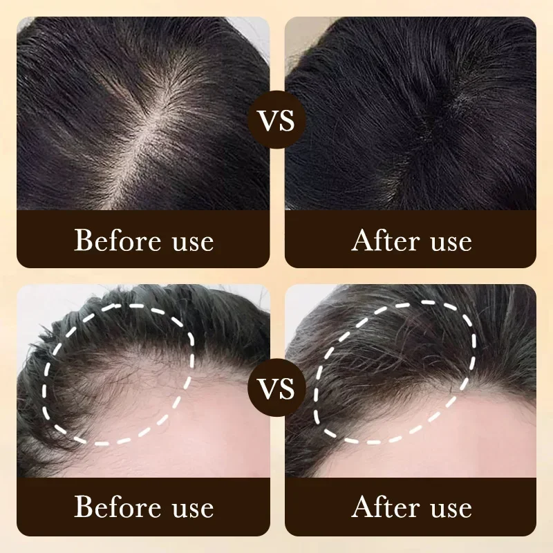 زيت البيوتين لنمو الشعر السريع - مراجعة Hair Care Frizzy Hair وسعره