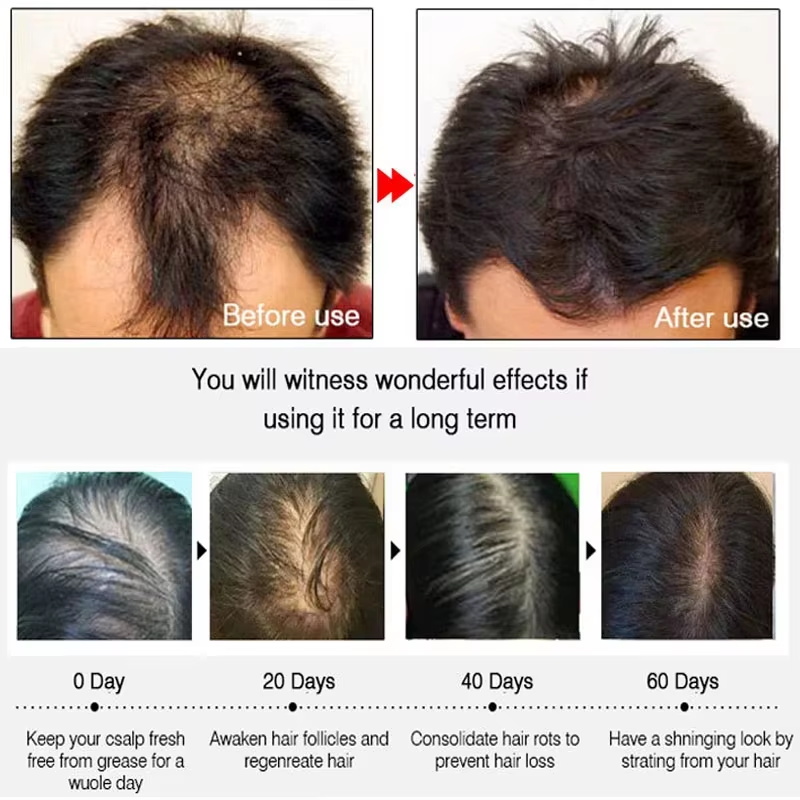 بخاخ الزنجبيل السريع لنمو الشع - مراجعة Hair Care Frizzy Hair وسعره